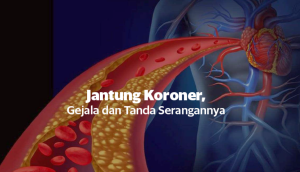 Jantung Koroner