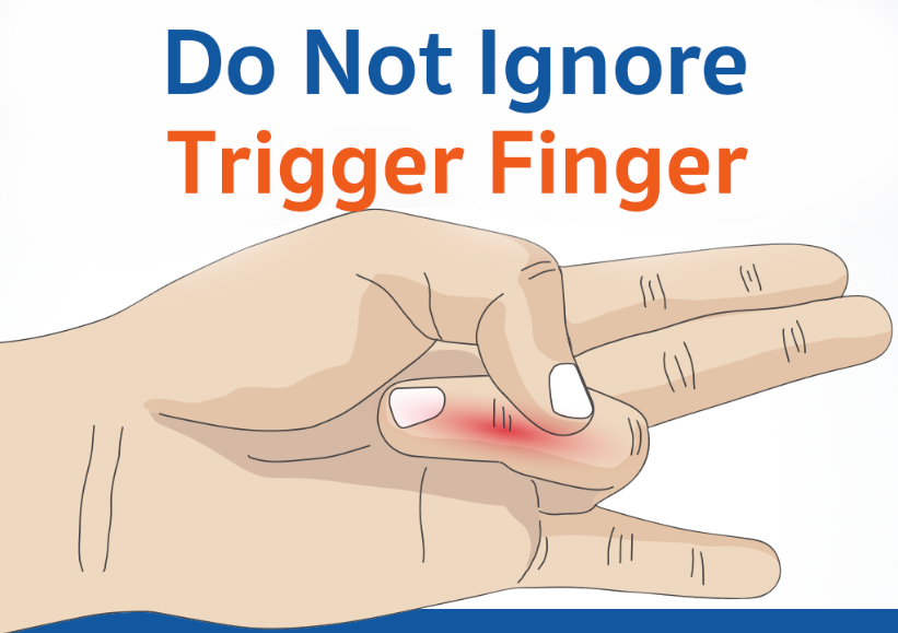 Trigger Finger