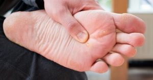 8 Cara Menghilangkan Kapalan di Kaki, Efektif untuk Dicoba!
