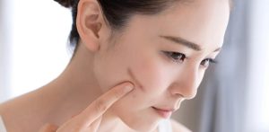 9 Cara Menghilangkan Bekas Luka di Wajah