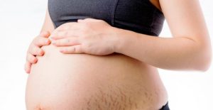 14 Cara menghilangkan stretch mark setelah melahirkan secara alami