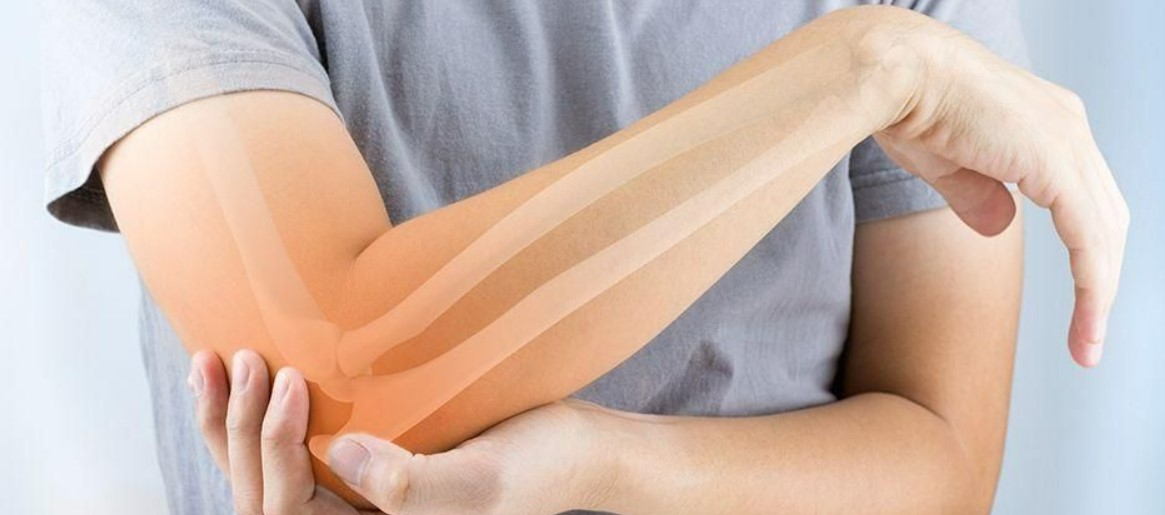 10 Cara Menjaga Kesehatan Tulang yang Harus Dilakukan