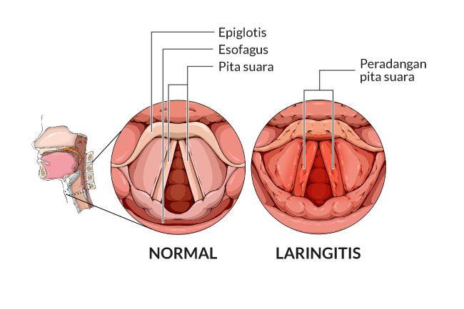 Pita Suara