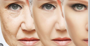 Memperlambat penuaan